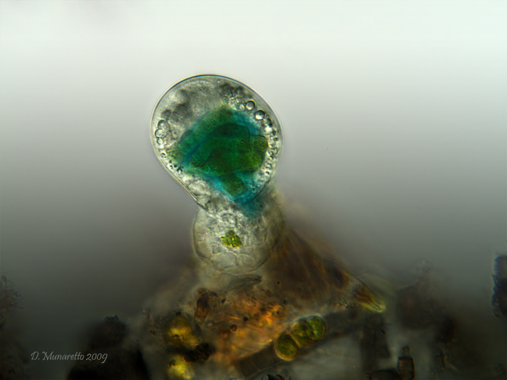 Amoeba con Cyanobatteri